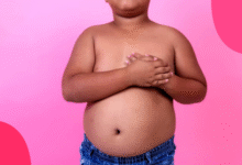 What Causes Obesity in Children