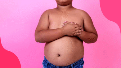 What Causes Obesity in Children