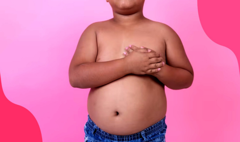 What Causes Obesity in Children
